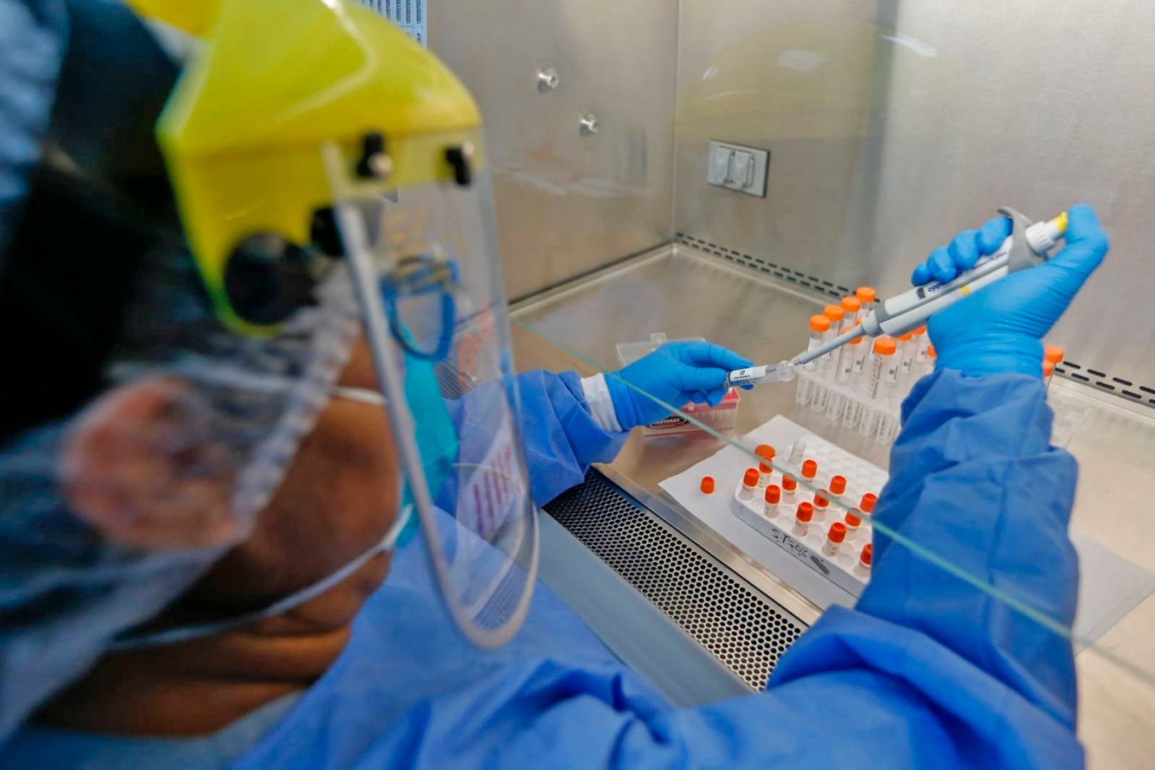 INVESTIGACIÓN. Equipos de científicos han documentado casos de reinfecciones por Covid-19 a través de análisis genéticos.