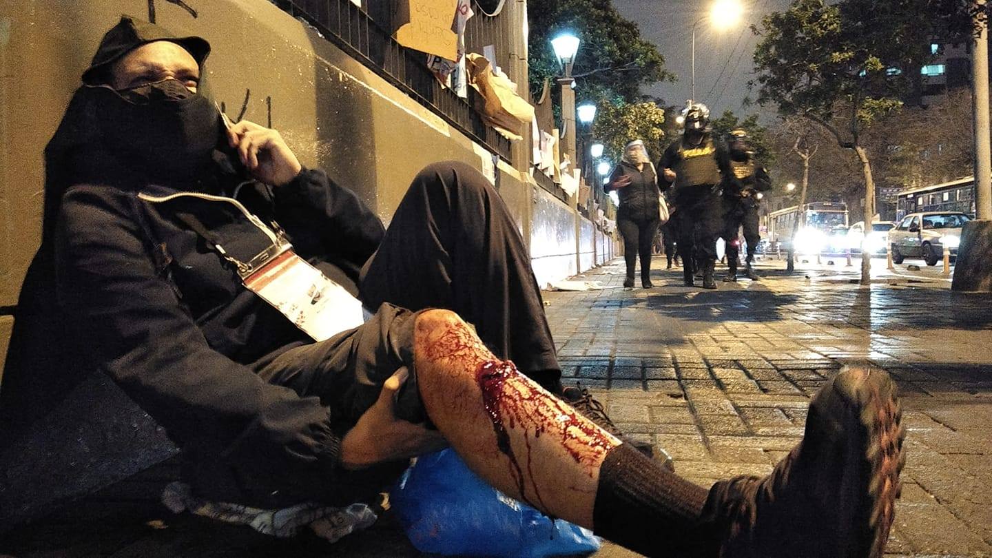 HERIDO. El periodista, luego de recibir el impacto de la bomba lacrimógena, debió enseñar su credencial a los efectivos para no ser golpeado.