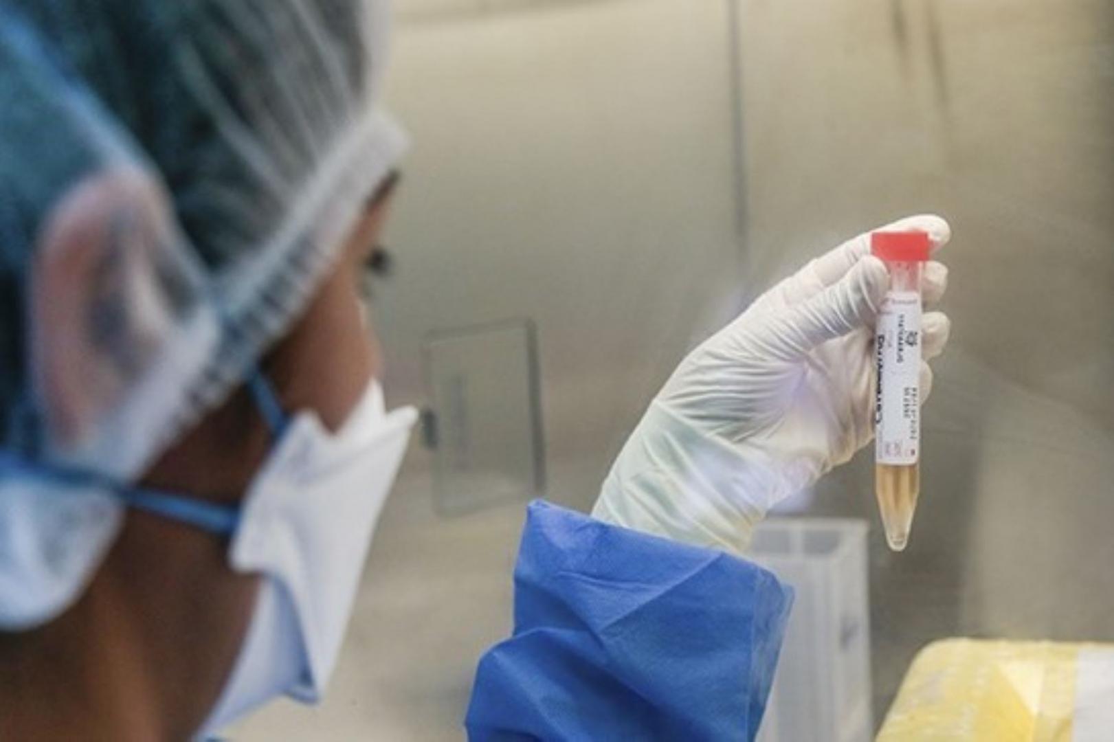 PRIMER CASO. Una mujer adulta de Lima que presentó síntomas de la Covid-19, fue diagnosticada con la variante británica.