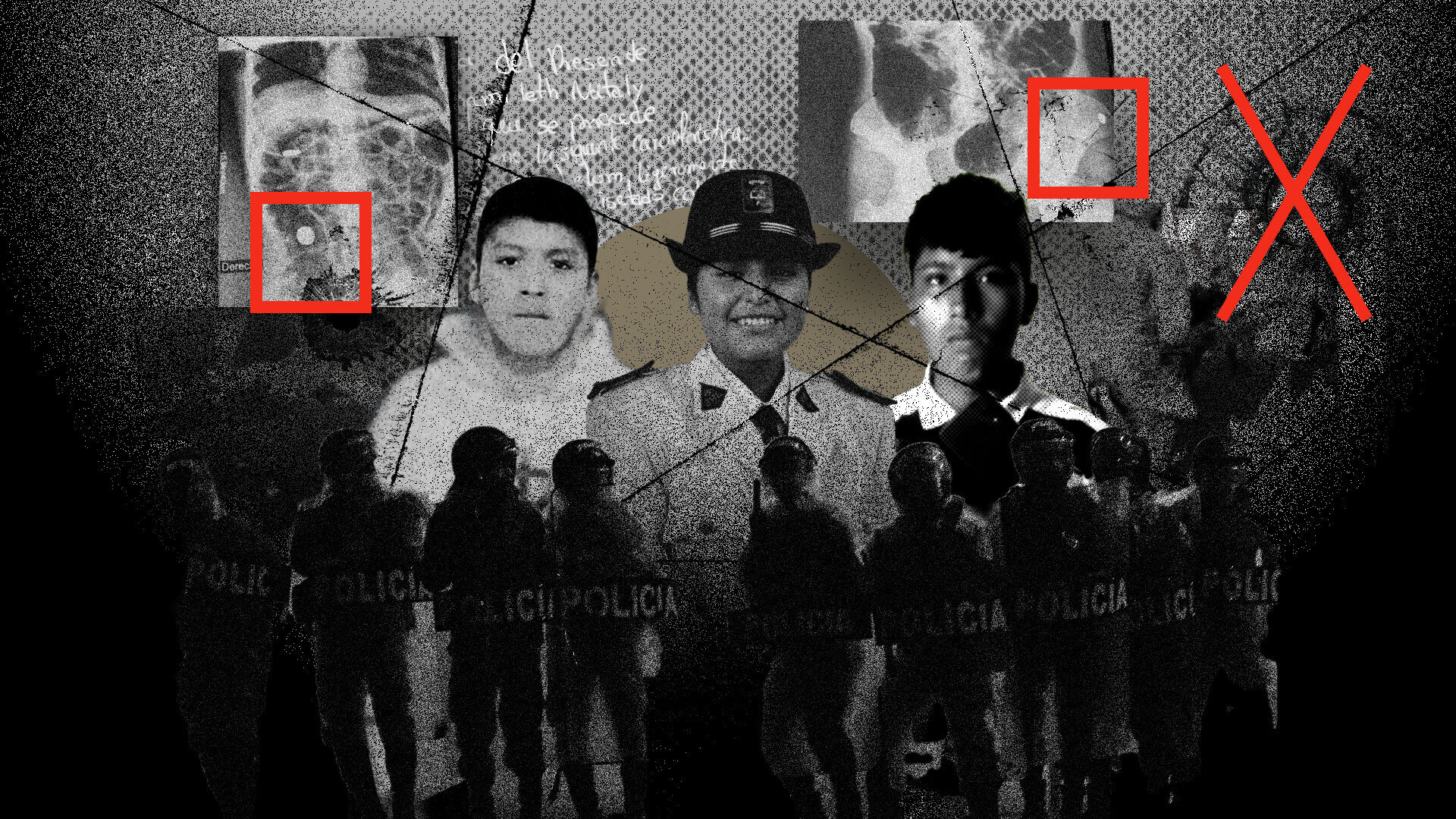 DOLOR. Elmer, Jhamileth, y Brayan recibieron impactos de proyectiles de armas de fuego durante la represión a las protestas del 9 de enero.
