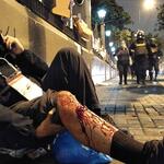 HERIDO. El periodista, luego de recibir el impacto de la bomba lacrimógena, debió enseñar su credencial a los efectivos para no ser golpeado.
