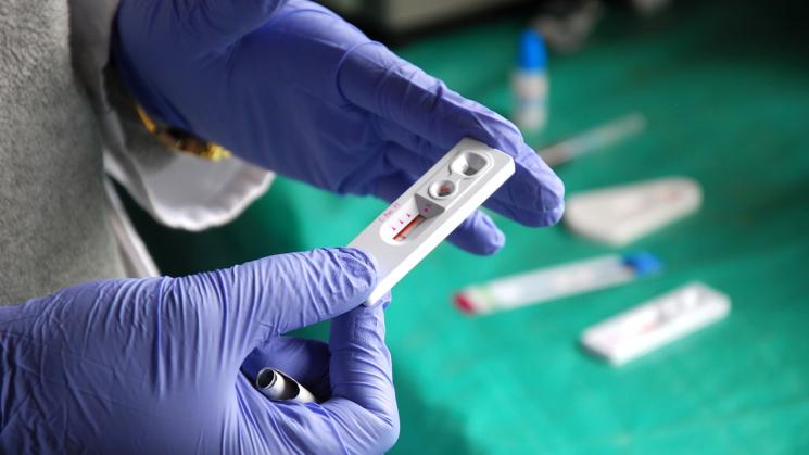 MENOS PRUEBAS. Hasta octubre solo se ha realizado el 66% de los tamizajes en comparación con el mismo periodo de 2019.