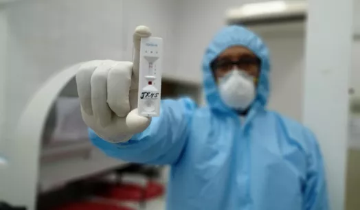 PRUEBAS RÁPIDAS. Los test serológicos -conocidos como pruebas rápidas- son los más usados en el Perú, a pesar de que no se recomienda su uso para el diagnóstico de casos.