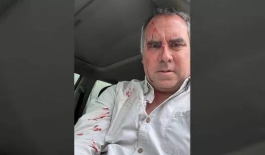 ATENTADO. Precandidato Rafael Belaunde fue atacado a balazos mientras se desplazaba en su vehículo.