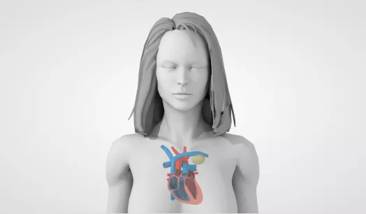 Implante de corazón de persona