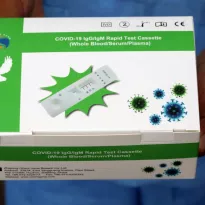 ESTRATEGIA. A contracorriente de Latinoamérica, los países de Perú y Puerto Rico apostaron por el uso de la prueba rápida para el diagnóstico de pacientes con Covid-19.