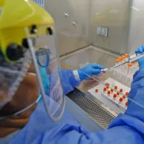 PRUEBAS. En el Perú, cuatro laboratorios cuentan con autorización del Instituto Nacional de Salud (INS) para realizar ensayos clínicos.