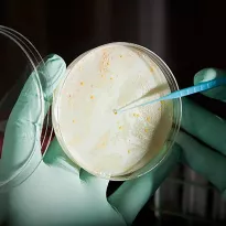 MICROORGANISMOS. Bacterias intrahospitalarias se pueden multiplicar en ambientes que no respetan protocolos.